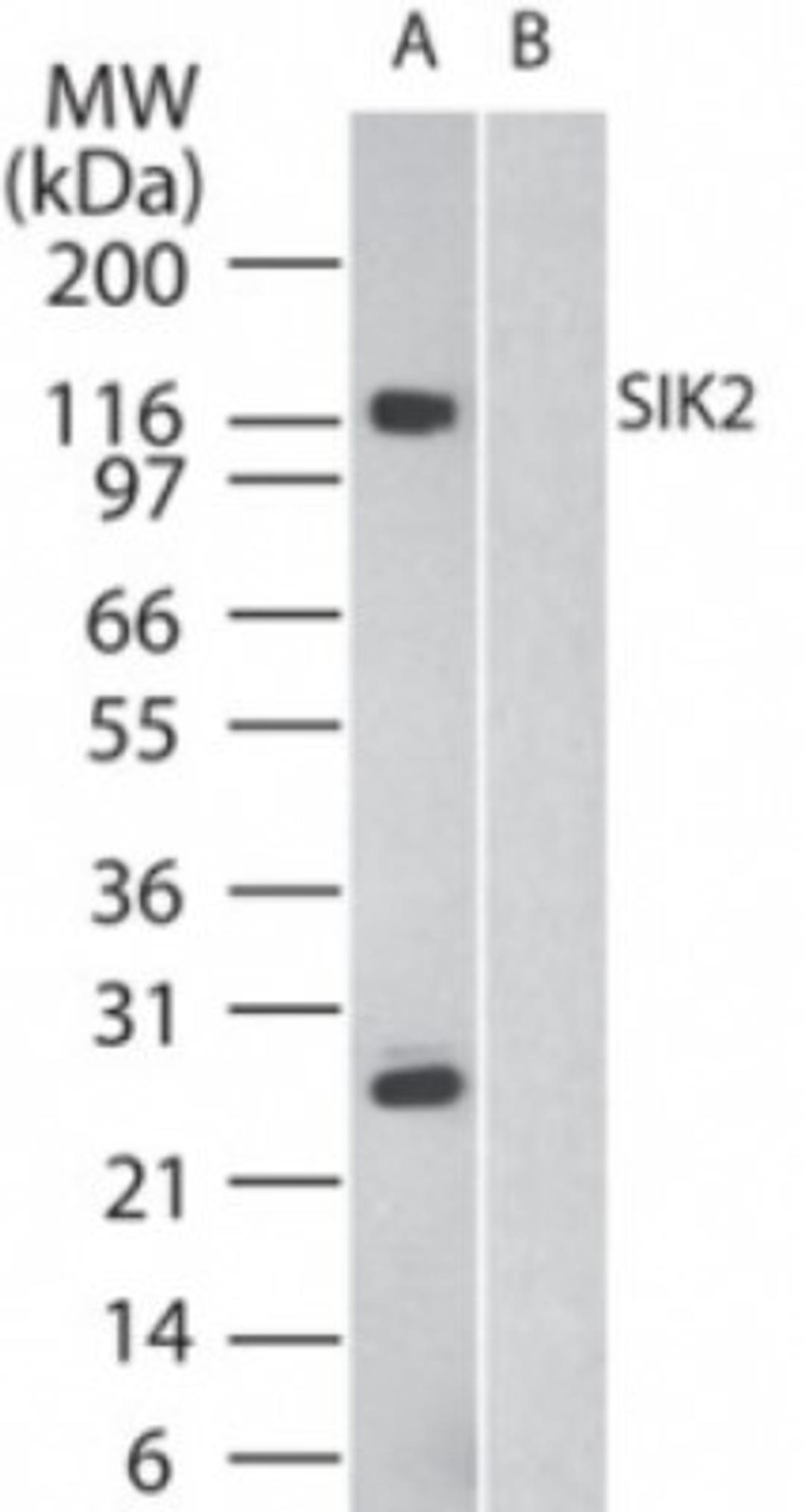 Western Blot: SIK2 Antibody [NB100-56458] - Western blot analysis of SIK2 in human brain in the A) absence and B) presence of immunizing peptide, using NB100-56458 at 2 ug/ml.