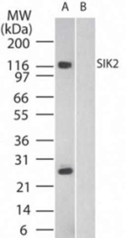 Western Blot: SIK2 Antibody [NB100-56458] - Western blot analysis of SIK2 in human brain in the A) absence and B) presence of immunizing peptide, using NB100-56458 at 2 ug/ml.