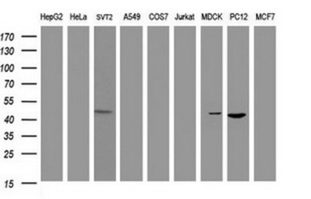 Western Blot: alpha-Methylacyl-CoA Racemase/AMACR Antibody (5F10) [NBP2-45491] - Analysis of extracts (35ug) from 9 different cell lines (HepG2: human; HeLa: human; SVT2: mouse; A549: human; COS7: monkey; Jurkat: human; MDCK: canine; PC12: rat; MCF7: human).