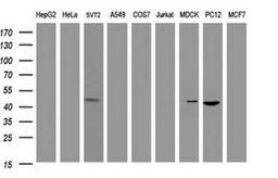 Western Blot: alpha-Methylacyl-CoA Racemase/AMACR Antibody (5F10) [NBP2-45491] - Analysis of extracts (35ug) from 9 different cell lines (HepG2: human; HeLa: human; SVT2: mouse; A549: human; COS7: monkey; Jurkat: human; MDCK: canine; PC12: rat; MCF7: human).