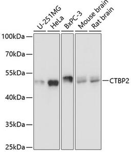 Western blot - CTBP2 Antibody (A2257)