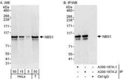 Detection of human NBS1 by western blot and immunoprecipitation.