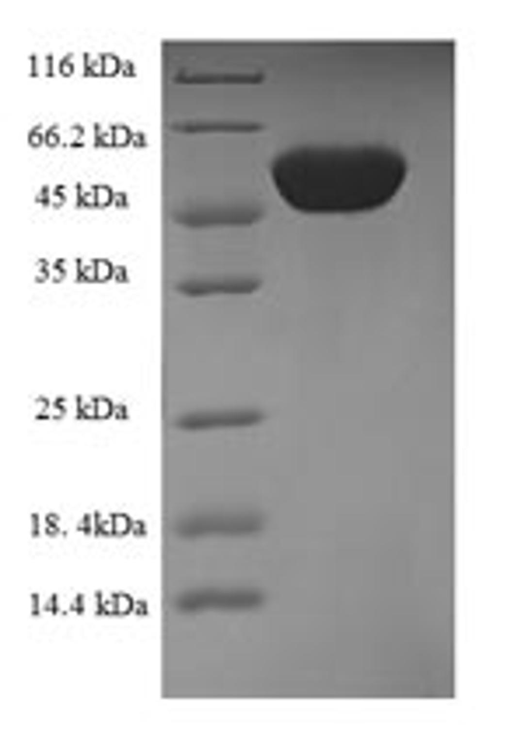 (Tris-Glycine gel) Discontinuous SDS-PAGE (reduced) with 5% enrichment gel and 15% separation gel.