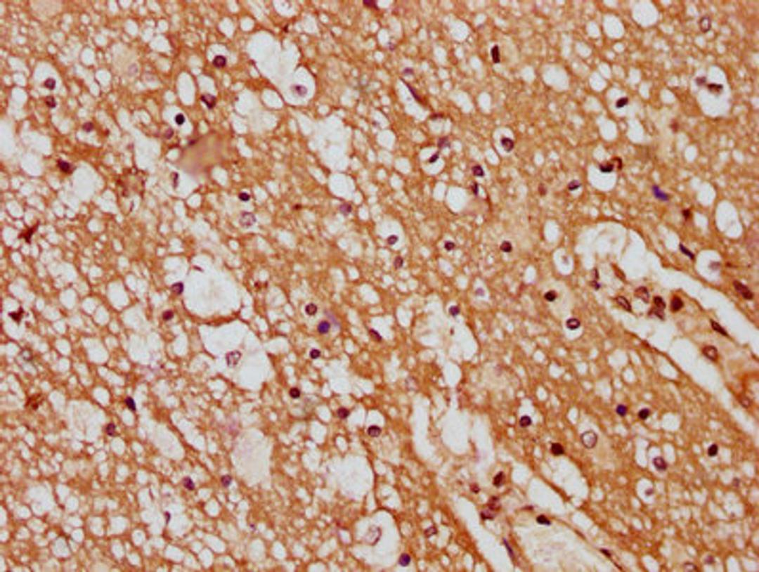 IHC image of CSB-PA736202LA01HU diluted at 1:400 and staining in paraffin-embedded human brain tissue performed on a Leica BondTM system. After dewaxing and hydration, antigen retrieval was mediated by high pressure in a citrate buffer (pH 6.0). Section was blocked with 10% normal goat serum 30min at RT. Then primary antibody (1% BSA) was incubated at 4&deg;C overnight. The primary is detected by a biotinylated secondary antibody and visualized using an HRP conjugated SP system.