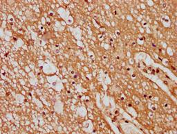 IHC image of CSB-PA736202LA01HU diluted at 1:400 and staining in paraffin-embedded human brain tissue performed on a Leica BondTM system. After dewaxing and hydration, antigen retrieval was mediated by high pressure in a citrate buffer (pH 6.0). Section was blocked with 10% normal goat serum 30min at RT. Then primary antibody (1% BSA) was incubated at 4&deg;C overnight. The primary is detected by a biotinylated secondary antibody and visualized using an HRP conjugated SP system.