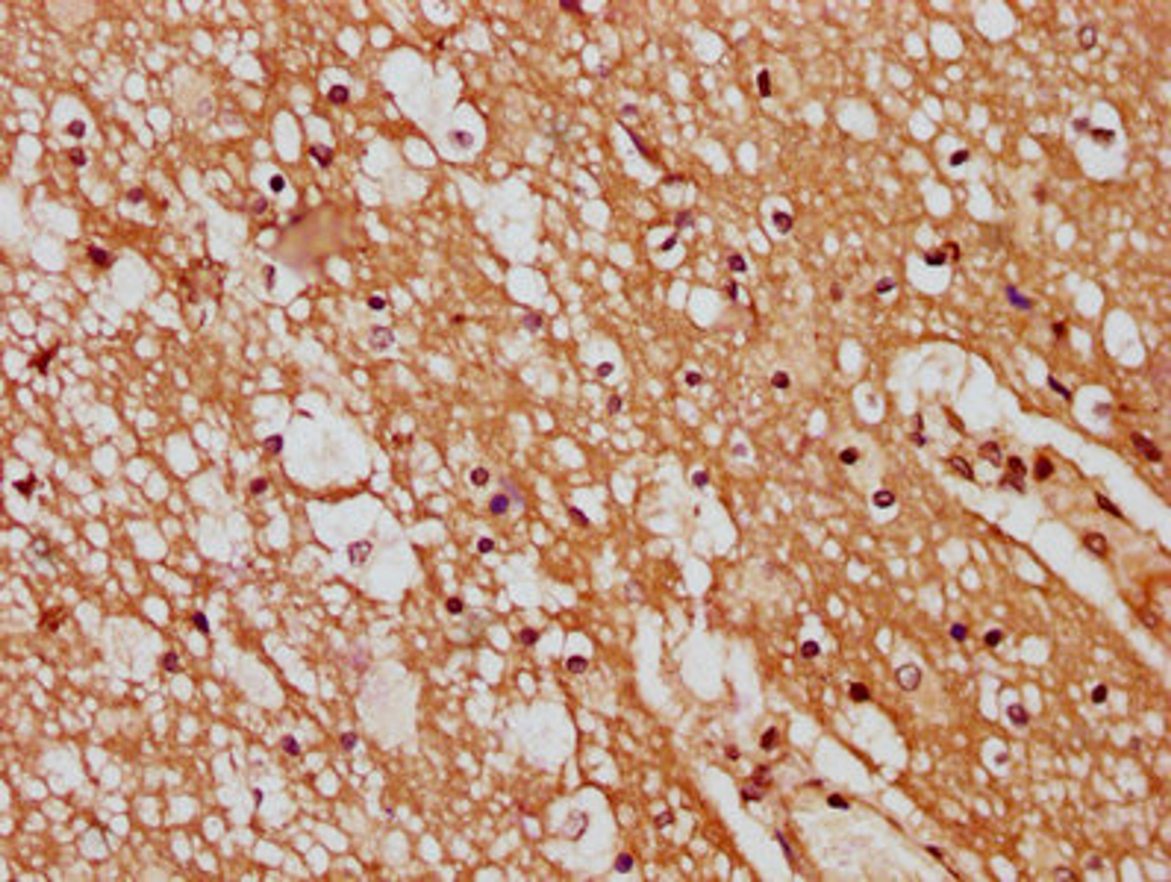 IHC image of CSB-PA736202LA01HU diluted at 1:400 and staining in paraffin-embedded human brain tissue performed on a Leica BondTM system. After dewaxing and hydration, antigen retrieval was mediated by high pressure in a citrate buffer (pH 6.0). Section was blocked with 10% normal goat serum 30min at RT. Then primary antibody (1% BSA) was incubated at 4&deg;C overnight. The primary is detected by a biotinylated secondary antibody and visualized using an HRP conjugated SP system.
