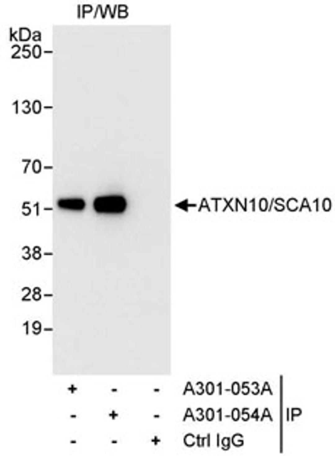 Detection of human ATXN10/SCA10 by western blot of immunoprecipitates.