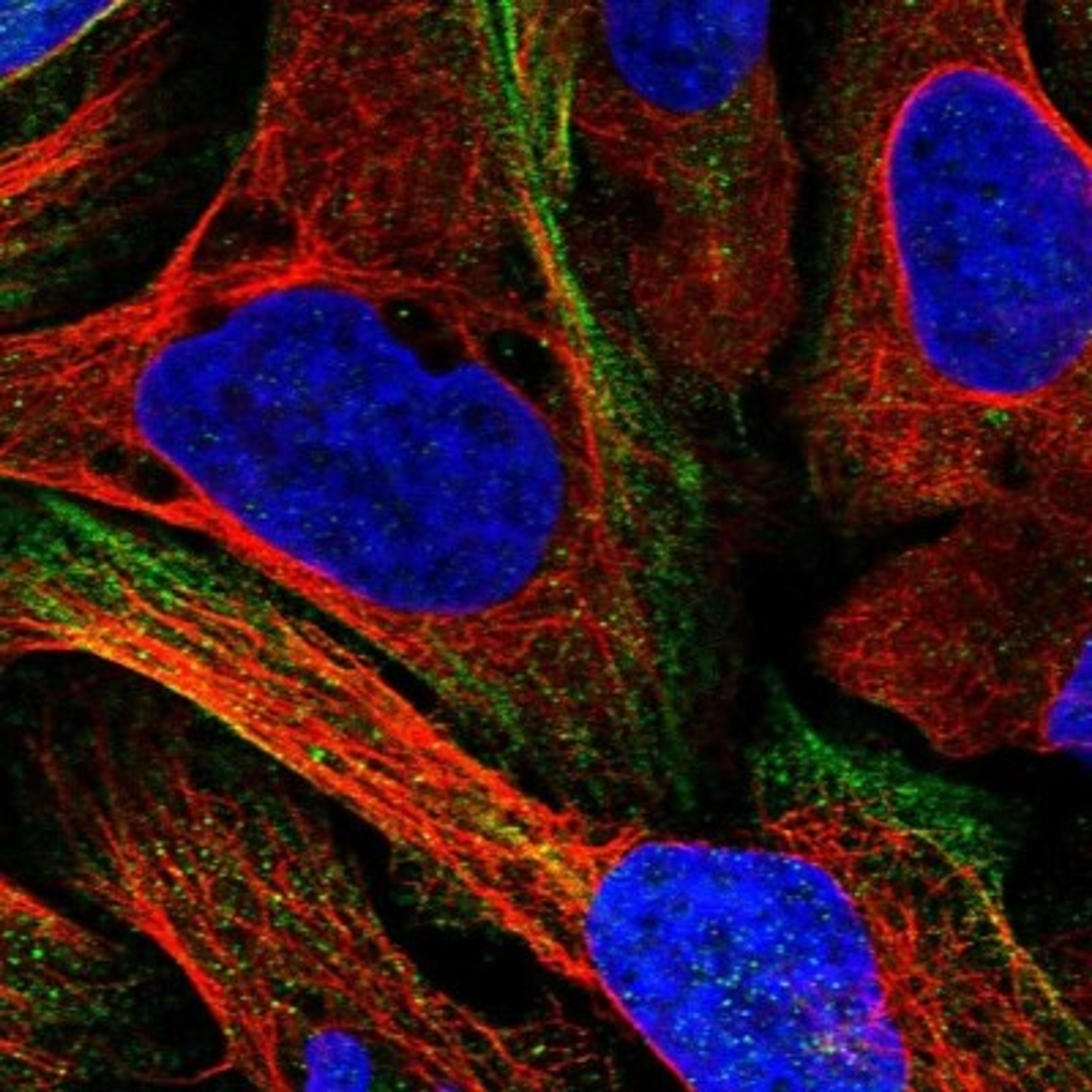 Immunocytochemistry/Immunofluorescence: CCDC172 Antibody [NBP1-82705] - Staining of human cell line U-2 OS shows positivity in cytoskeleton (actin filaments).