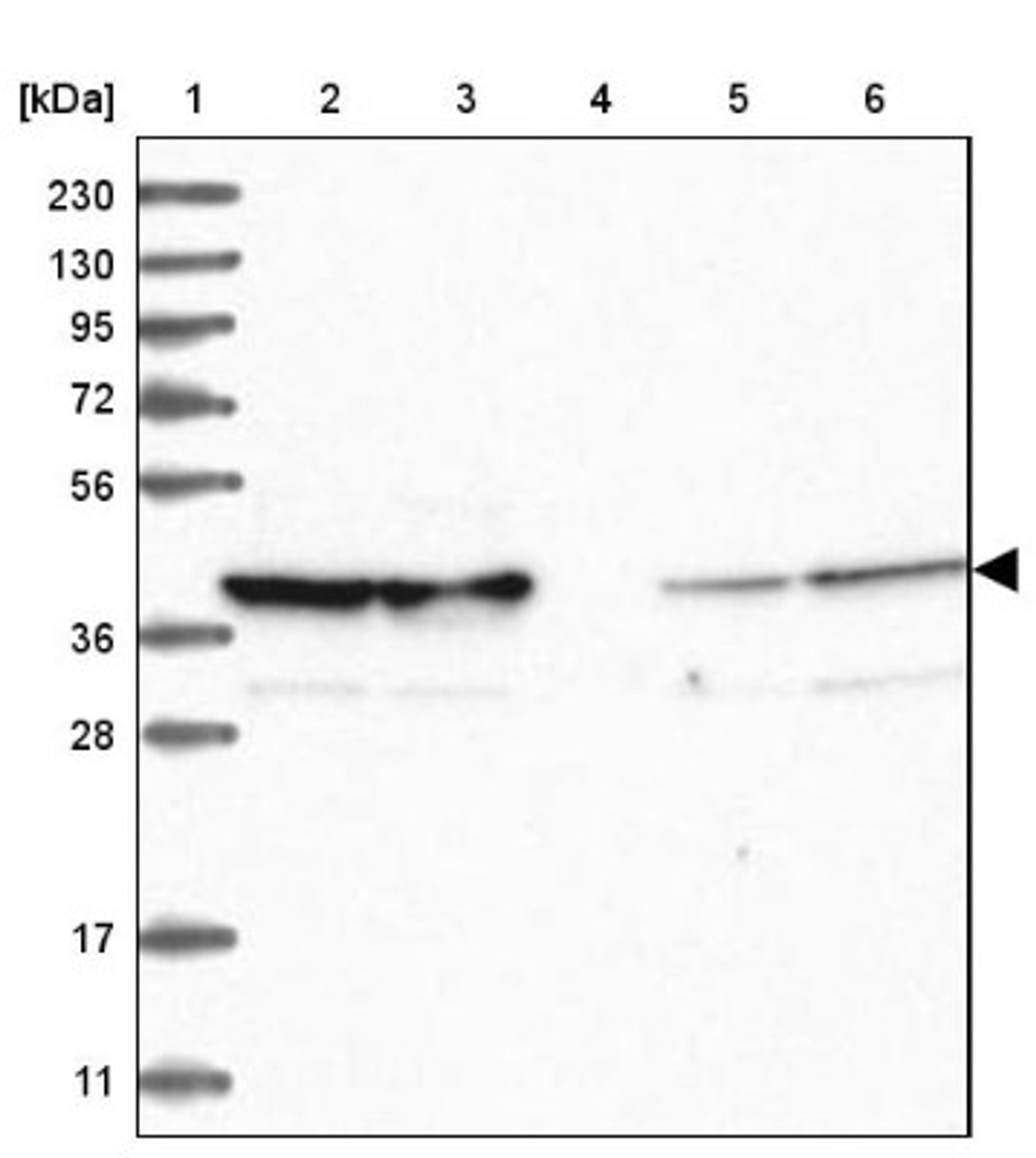 Western Blot: TOMM40 Antibody [NBP2-38289] - Lane 1: Marker [kDa] 230, 130, 95, 72, 56, 36, 28, 17, 11<br/>Lane 2: RT-4<br/>Lane 3: U-251 MG<br/>Lane 4: Human Plasma<br/>Lane 5: Liver<br/>Lane 6: Tonsil