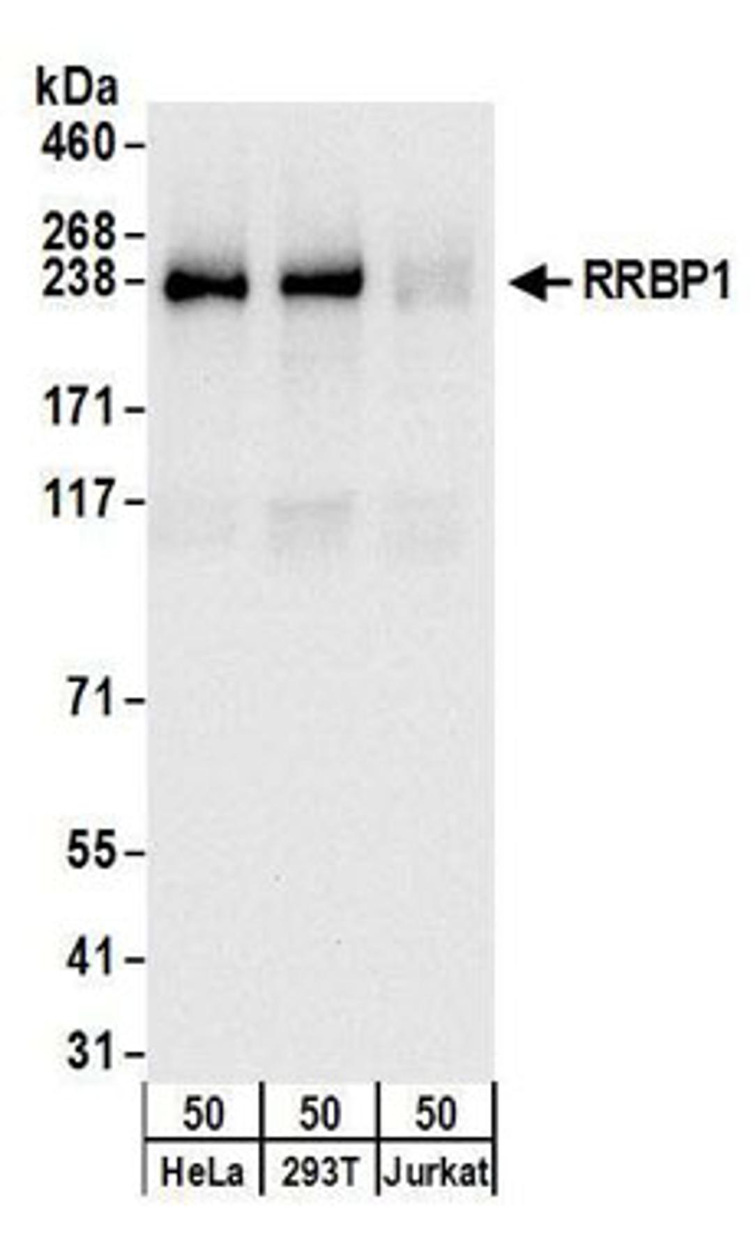 Detection of human RRBP1 by western blot.