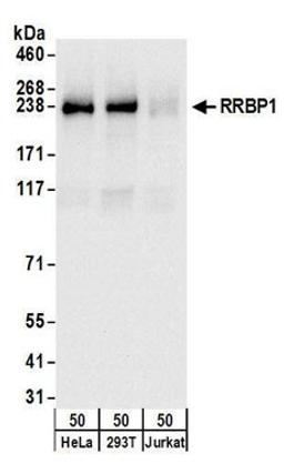 Detection of human RRBP1 by western blot.