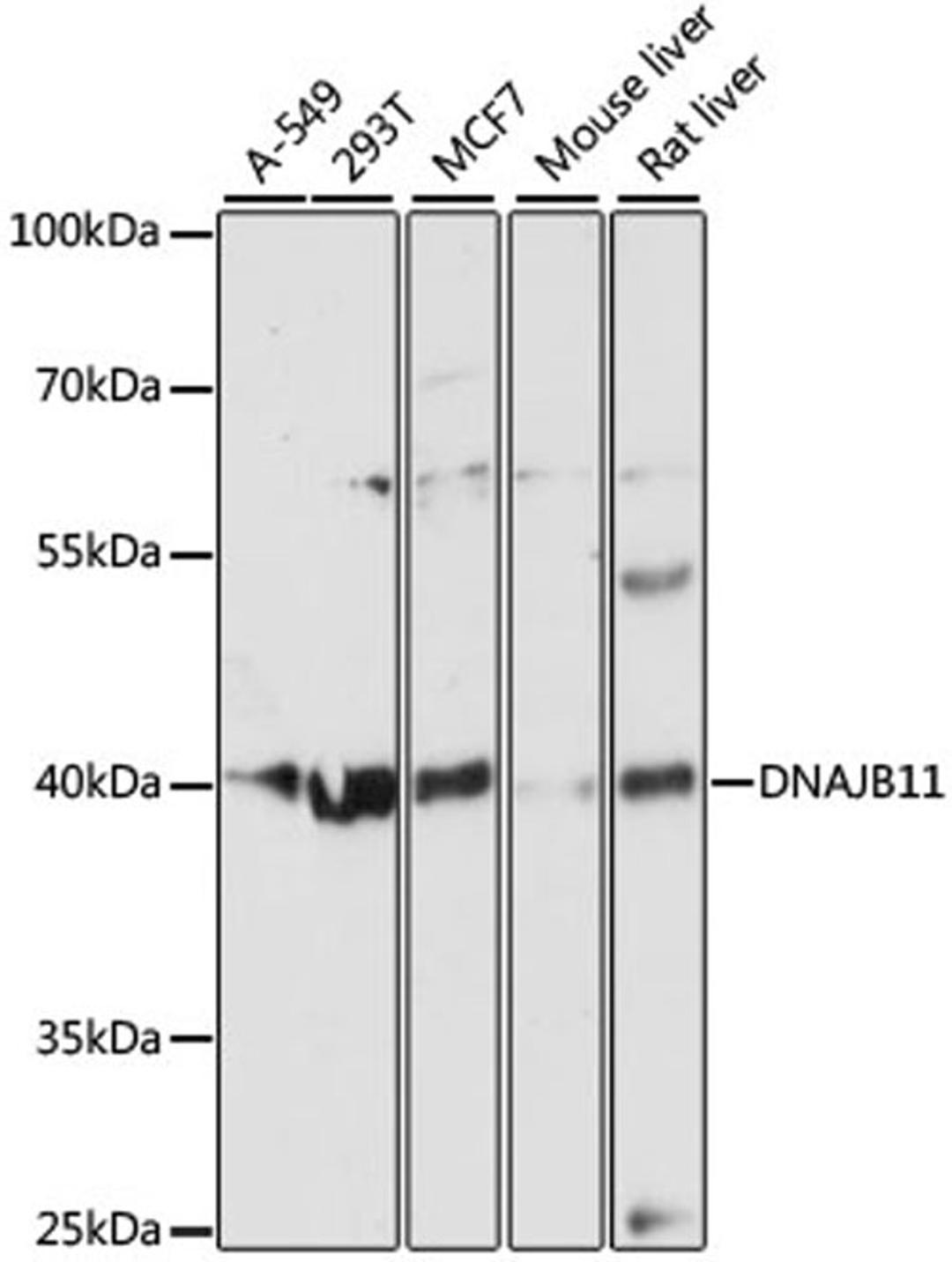 Western blot - DNAJB11 antibody (A12915)