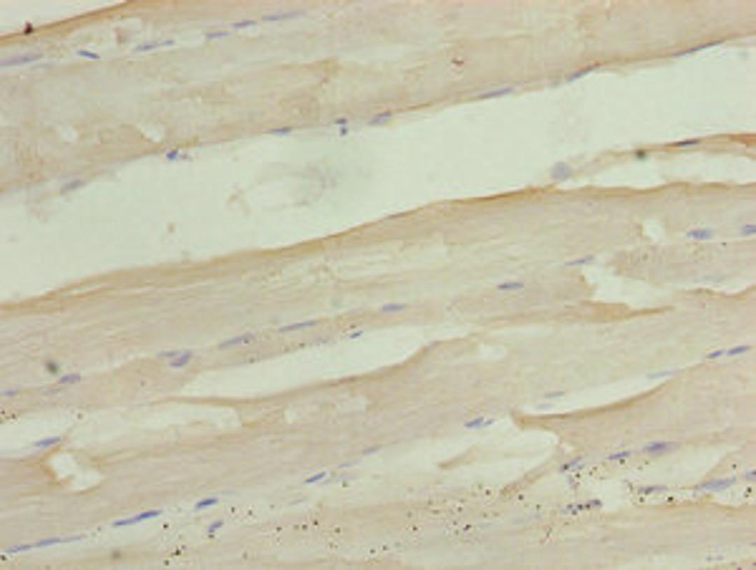 Immunohistochemistry of paraffin-embedded human skeletal muscle tissue using CSB-PA800096LA01HU at dilution of 1:100