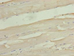 Immunohistochemistry of paraffin-embedded human skeletal muscle tissue using CSB-PA800096LA01HU at dilution of 1:100