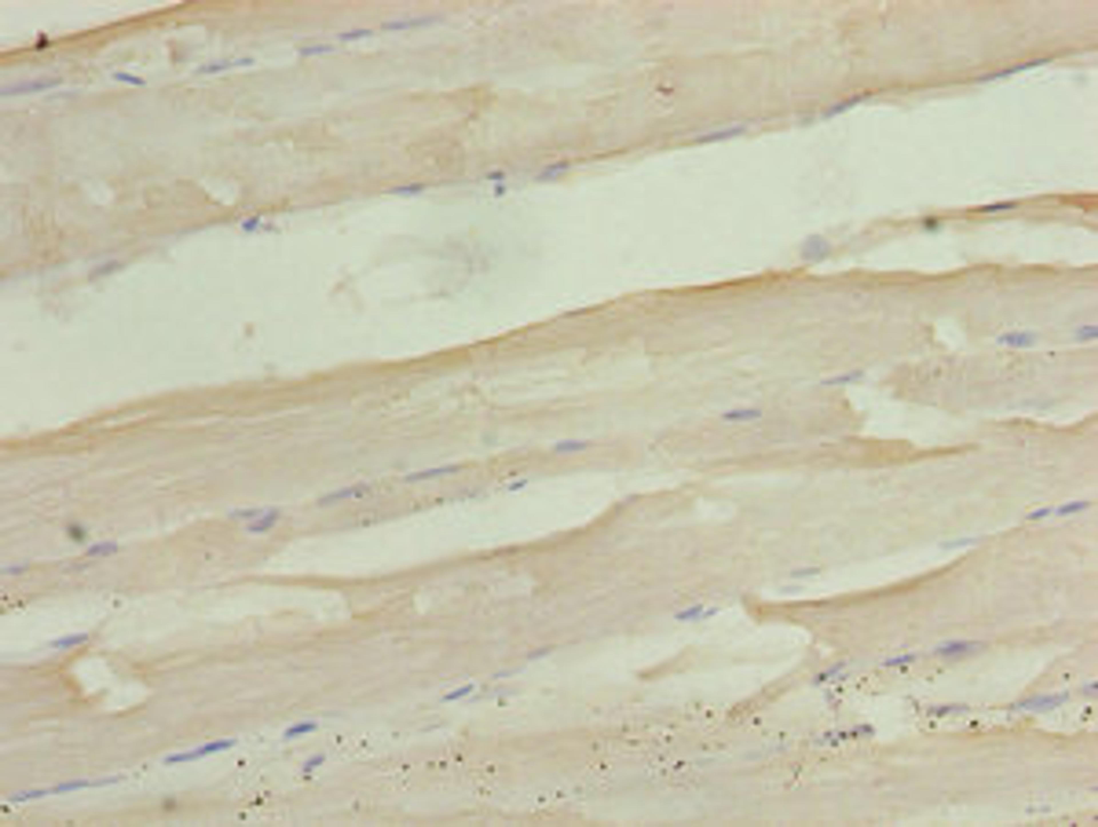 Immunohistochemistry of paraffin-embedded human skeletal muscle tissue using CSB-PA800096LA01HU at dilution of 1:100