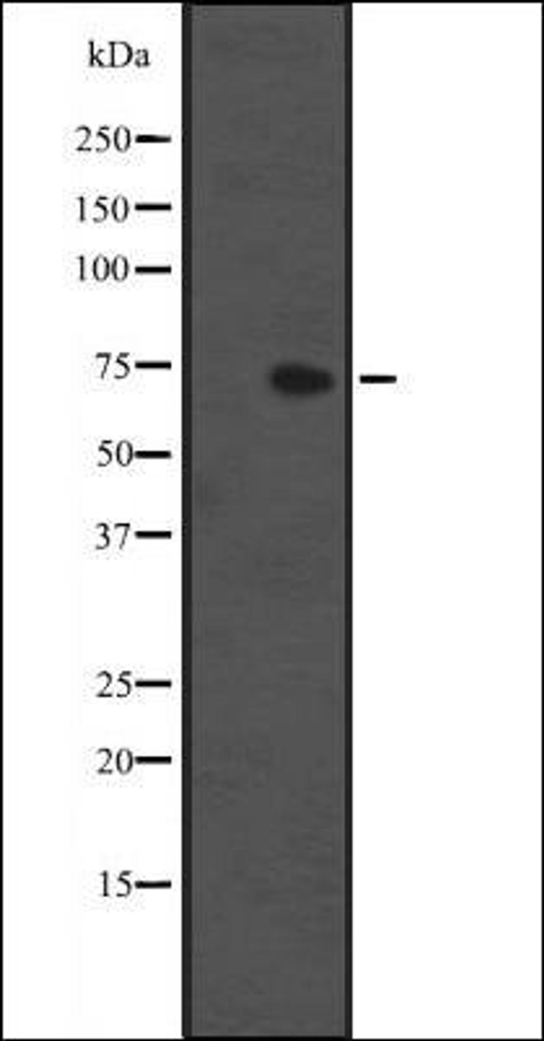 Western blot analysis of HEK293 cells using IL1RL1 antibody