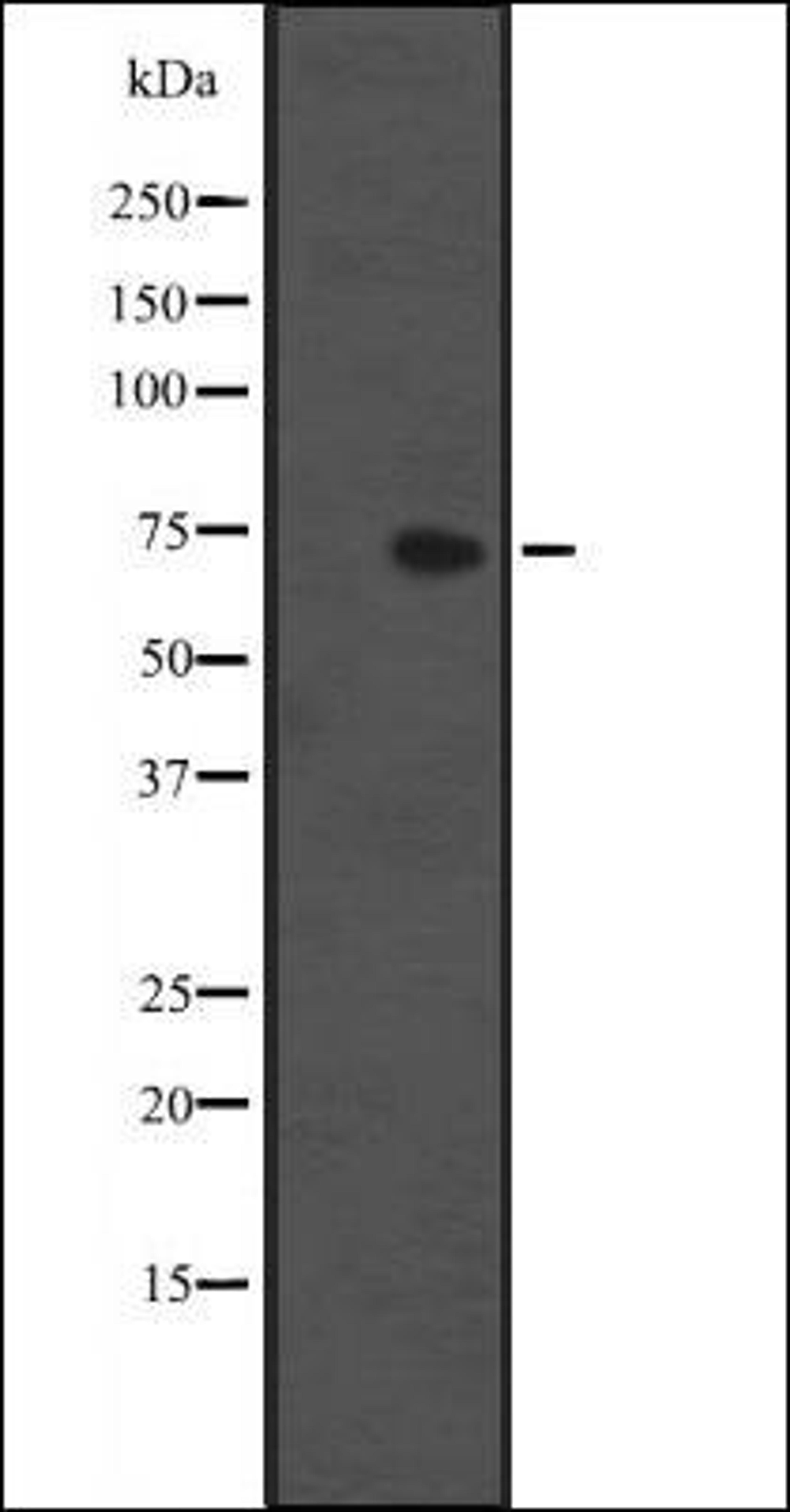 Western blot analysis of HEK293 cells using IL1RL1 antibody