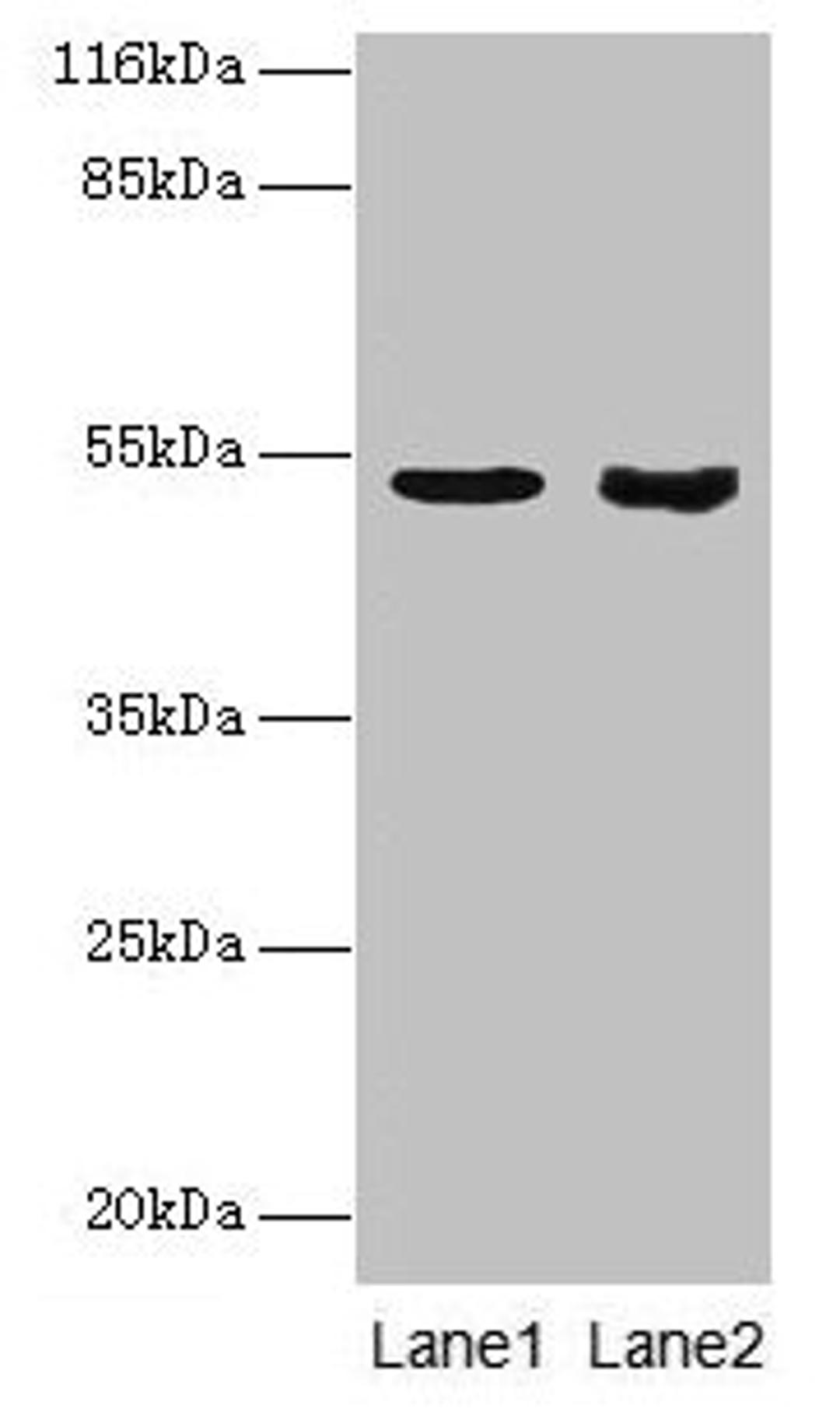 Western blot. All lanes: SKP2 antibody at 2µg/ml. Lane 1: Jurkat whole cell lysate. Lane 2: Hela whole cell lysate. Secondary. Goat polyclonal to rabbit IgG at 1/10000 dilution. Predicted band size: 48, 47, 24 kDa. Observed band size: 48 kDa