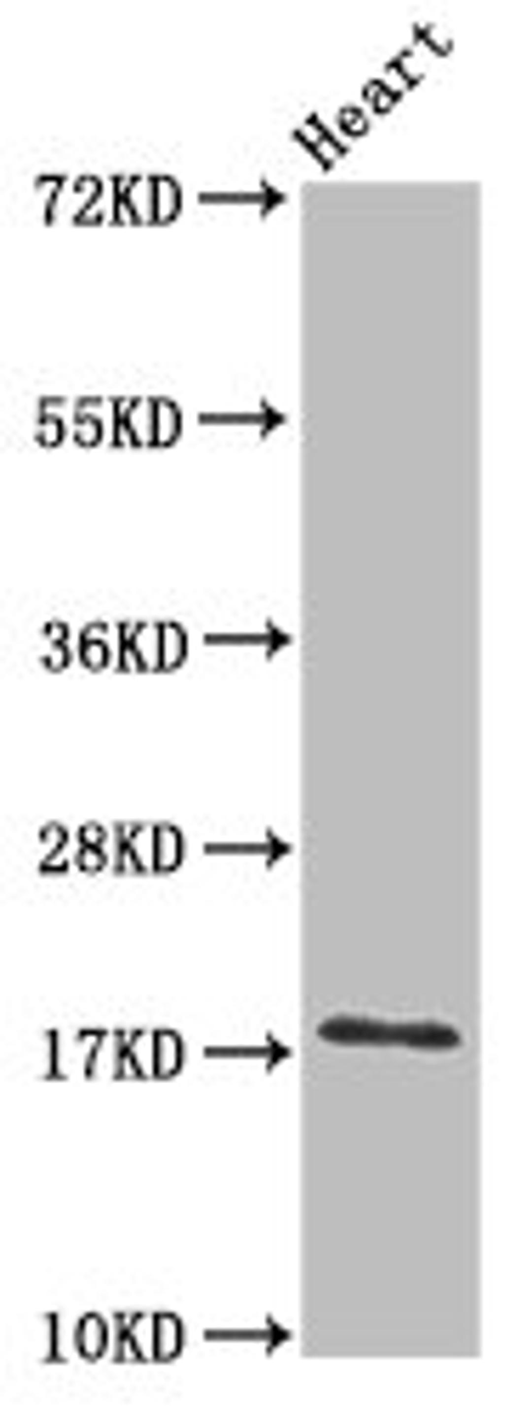 Western Blot. Positive WB detected in: Mouse heart tissue. All lanes: UBE2L3 antibody at 3ug/ml. Secondary. Goat polyclonal to rabbit IgG at 1/50000 dilution. Predicted band size: 18, 15, 25 kDa. Observed band size: 18 kDa.