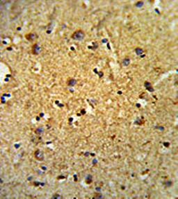Immunohistrochemical analysis of formalin-fixed and paraffin-embedded human brain tissue using LOX-1 antibody