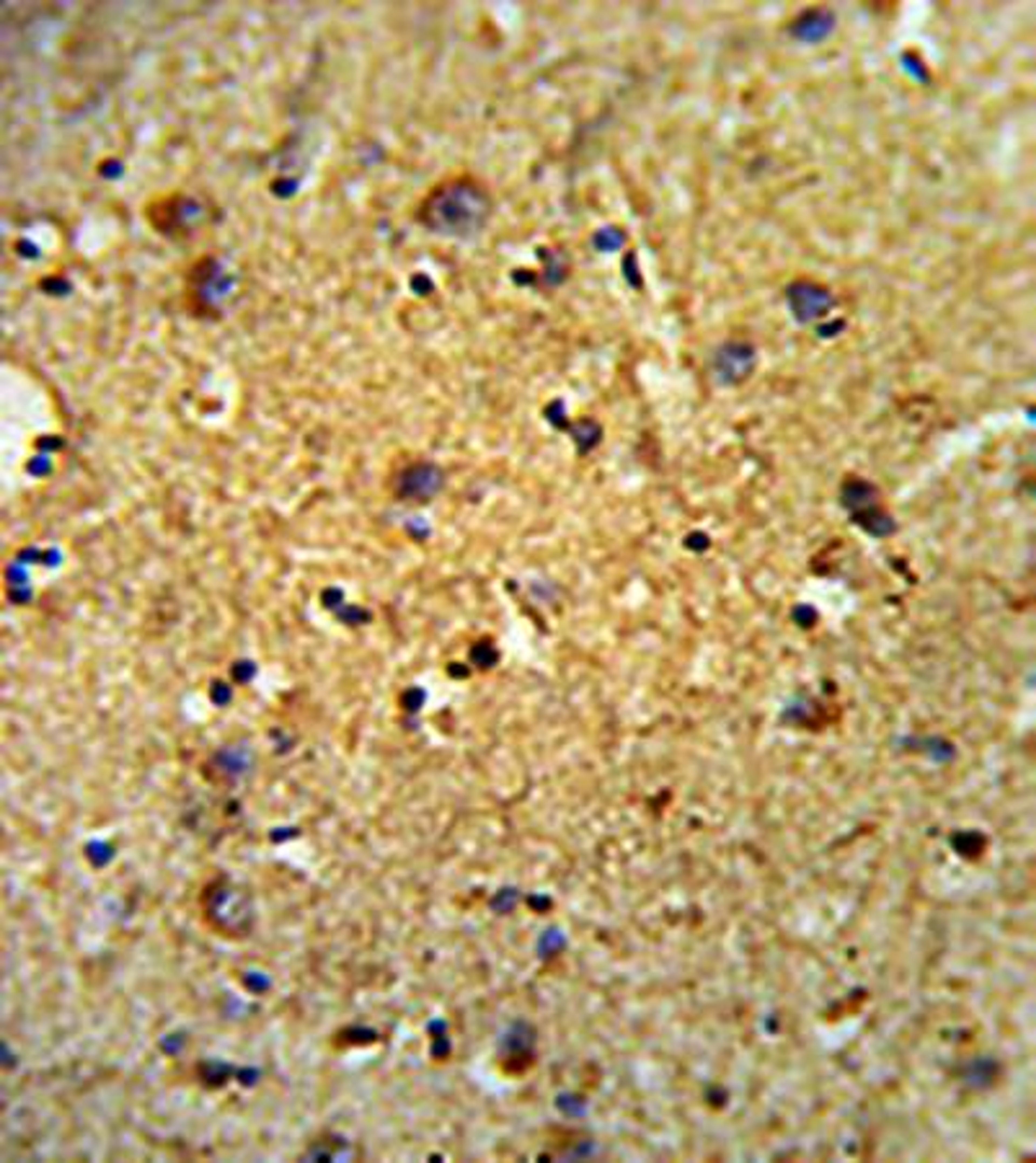 Immunohistrochemical analysis of formalin-fixed and paraffin-embedded human brain tissue using LOX-1 antibody