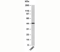 Western blot testing of human samples with CRHR2 antibody at 0.5ug/ml.