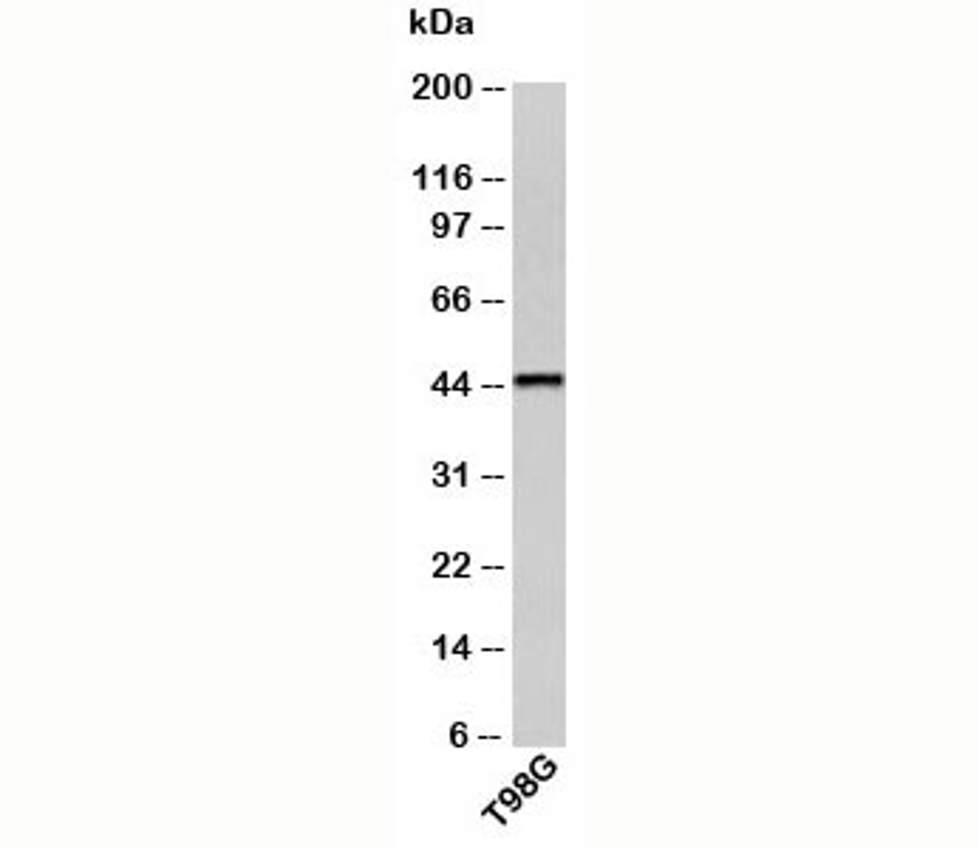 Western blot testing of human samples with CRHR2 antibody at 0.5ug/ml.