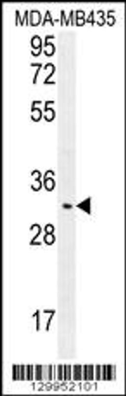 Western blot analysis in MDA-MB435 cell line lysates (35ug/lane).