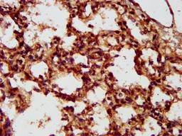 IHC image of CSB-PA873714LA01HU diluted at 1:300 and staining in paraffin-embedded human lung tissue performed on a Leica BondTM system. After dewaxing and hydration, antigen retrieval was mediated by high pressure in a citrate buffer (pH 6.0). Section was blocked with 10% normal goat serum 30min at RT. Then primary antibody (1% BSA) was incubated at 4°C overnight. The primary is detected by a biotinylated secondary antibody and visualized using an HRP conjugated SP system.