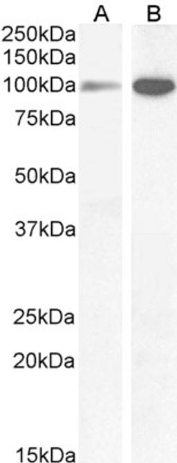 45-971 (1ug/ml) staining of Human Amylgada (A) and Rat (B) Brain lysate (35ug protein in RIPA buffer). Primary incubation was 1 hour. Detected by chemiluminescence.