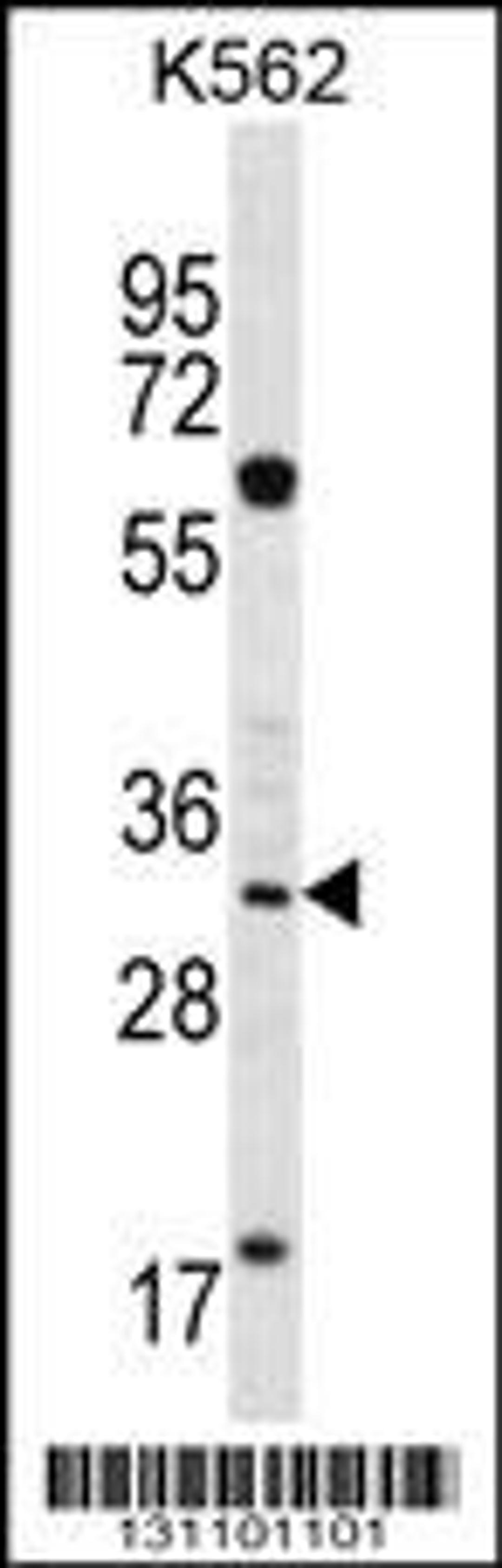 Western blot analysis of FCN3 antibody in K562 cell line lysates