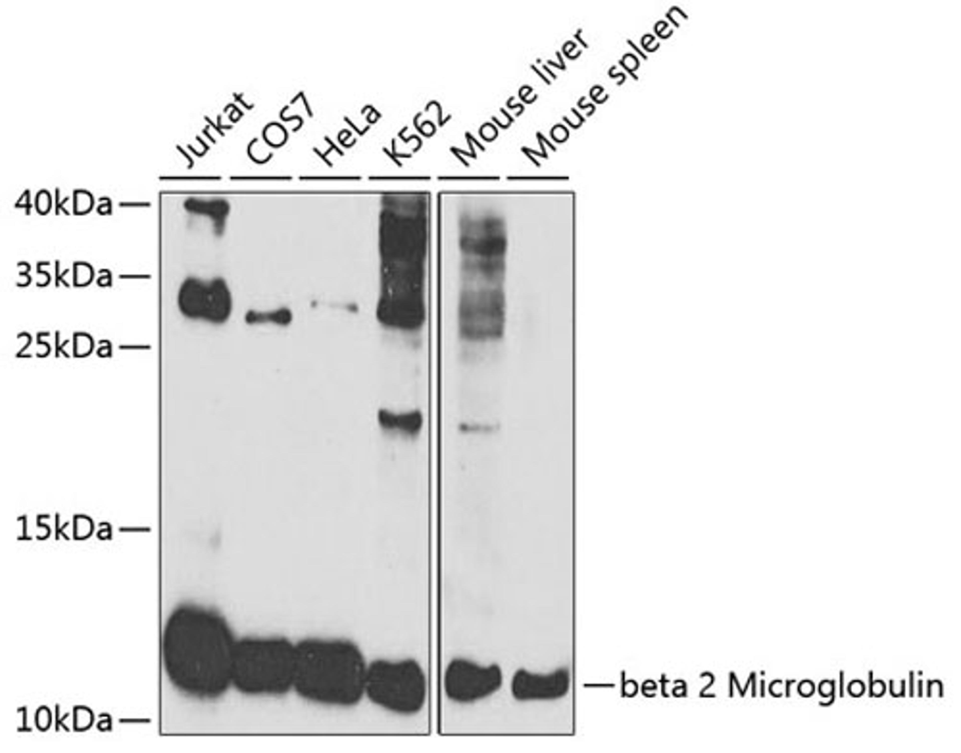 Western blot - beta 2 Microglobulin antibody (A12404)