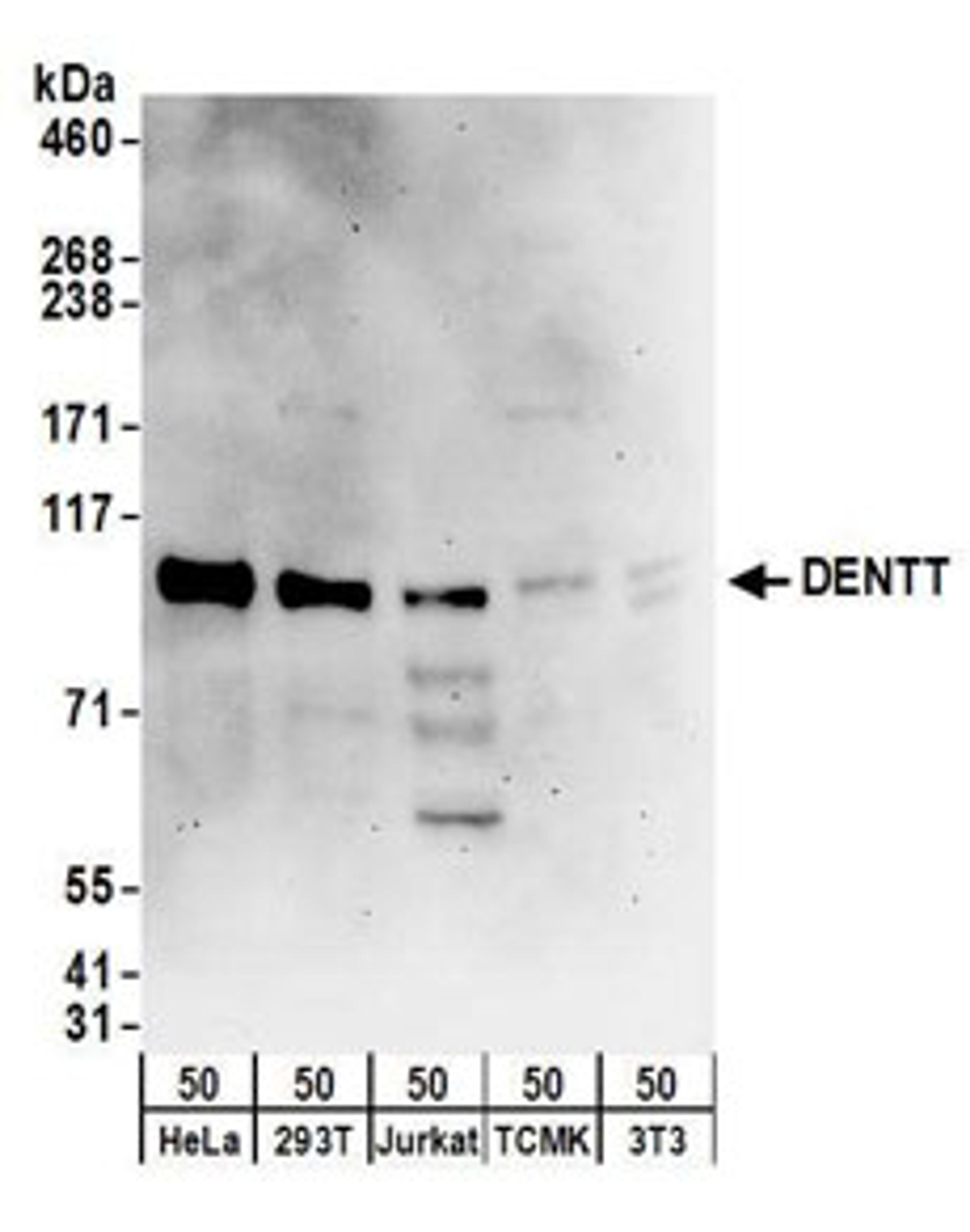 Detection of human DENTT by western blot.