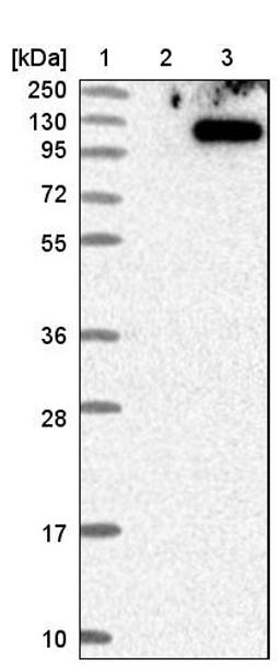 Western Blot: TSR1 Antibody [NBP1-84619] - Lane 1: Marker [kDa] 250, 130, 95, 72, 55, 36, 28, 17, 10<br/>Lane 2: Negative control (vector only transfected HEK293T lysate)<br/>Lane 3: Over-expression lysate (Co-expressed with a C-terminal myc-DDK tag (~3.1 kDa) in mammalian HEK293T cells, LY413281)