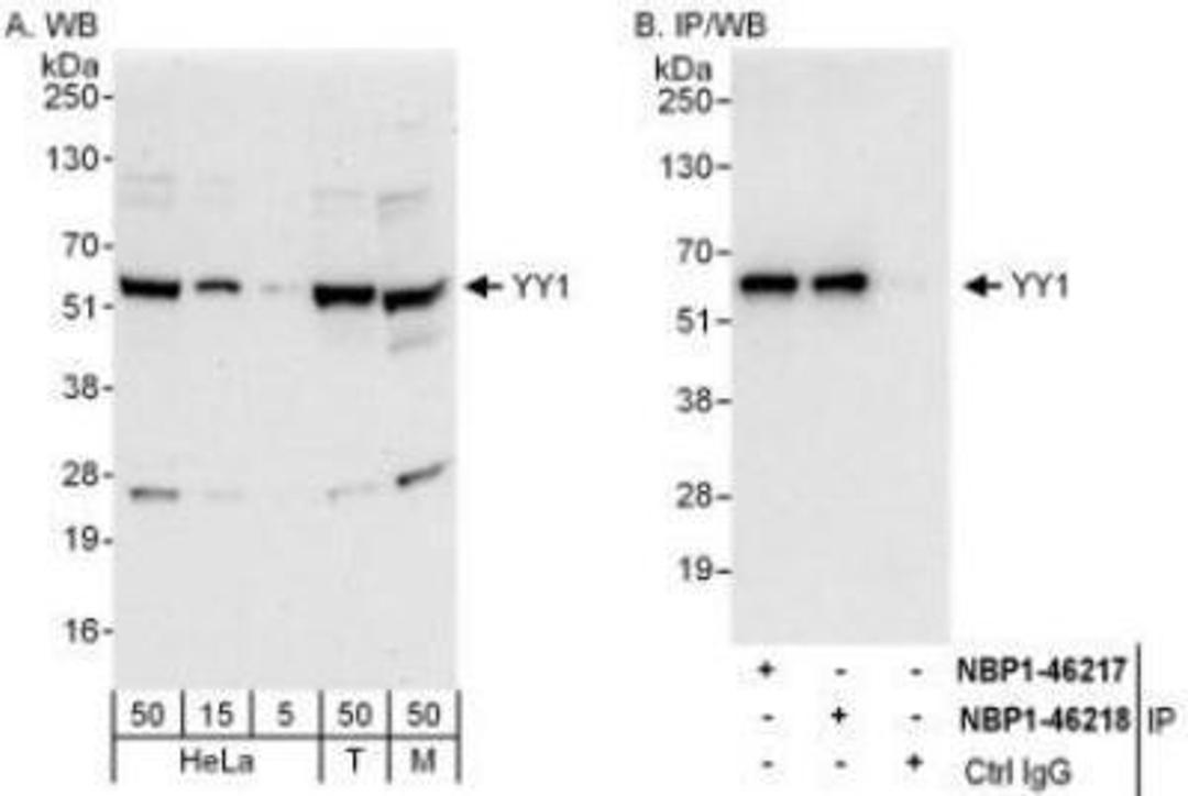 Western Blot: YY1 Antibody [NBP1-46218] - Whole cell lysate from HeLa (5, 15 and 50 mcg for WB; 1 mg for IP, 20% of IP loaded), 293T (T; 50 mcg), and mouse NIH3T3 (M; 50 mcg) cells. Affinity purified rabbit anti-YY1 antibody used for WB at 0.04 mcg/ml (A) and 1 mcg/ml (B) and used for IP at 3 mcg/mg lysate.  YY1 was also immunoprecipitated by rabbit anti-YY1 antibody NBP1-46217, which recognizes an upstream epitope.