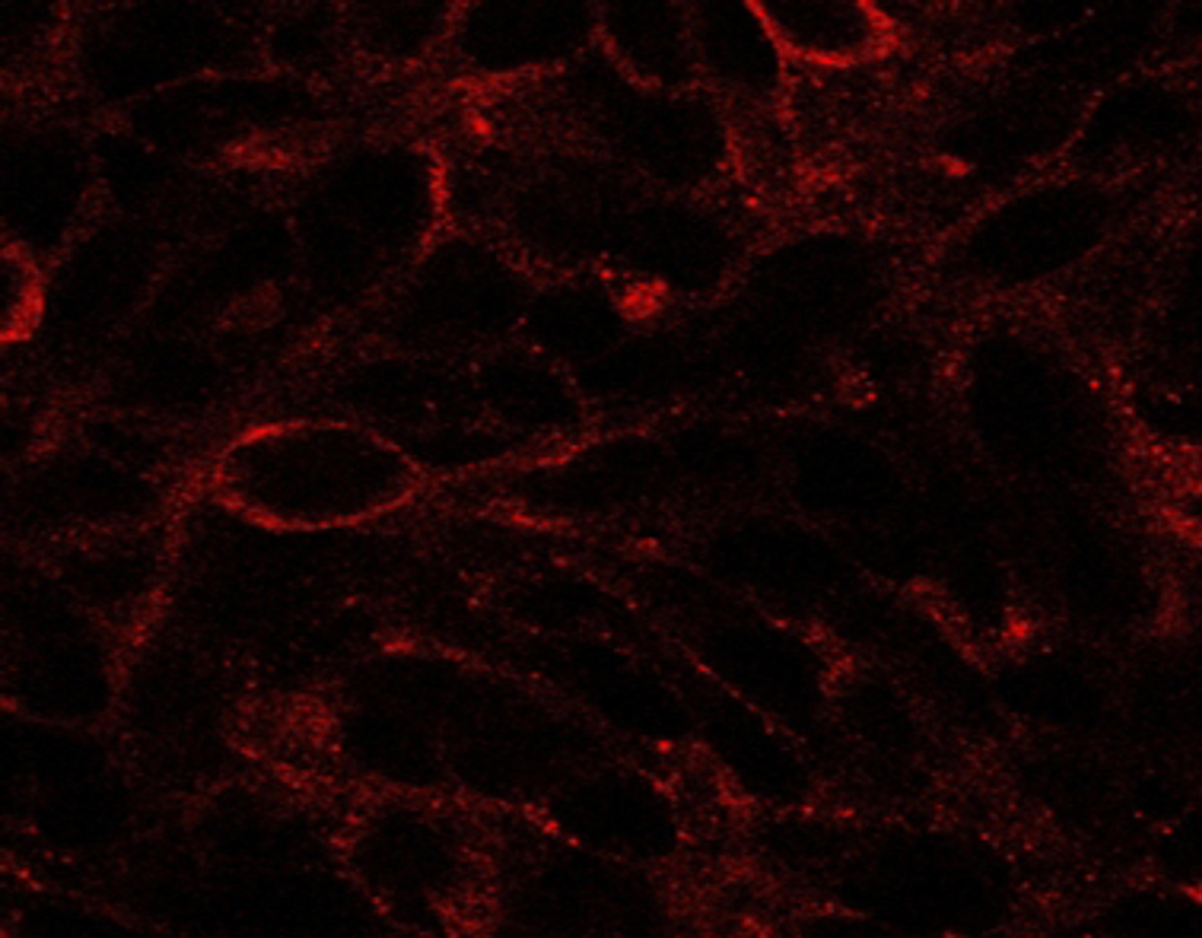 45-482 (2.5ug/ml) staining of U87. Detected by immunofluorescence. 