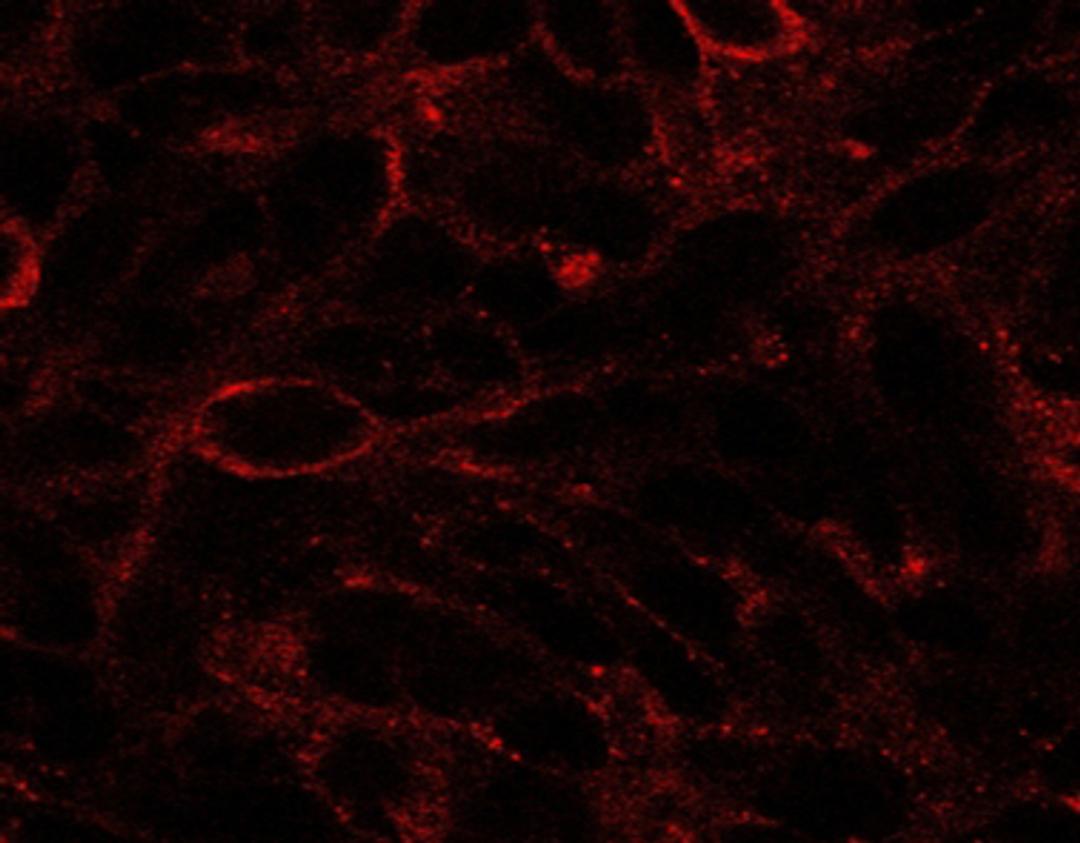 45-482 (2.5ug/ml) staining of U87. Detected by immunofluorescence.