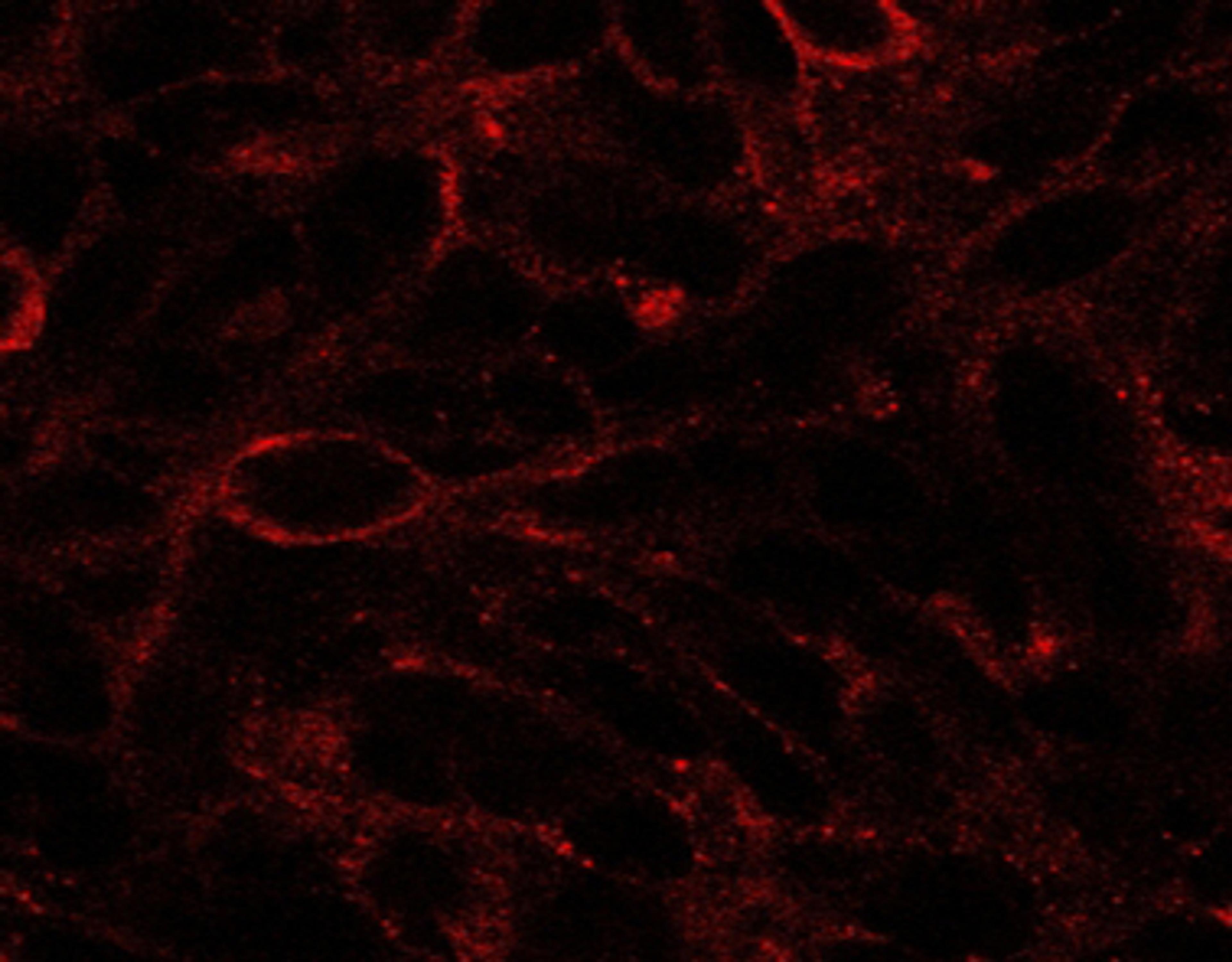 45-482 (2.5ug/ml) staining of U87. Detected by immunofluorescence.