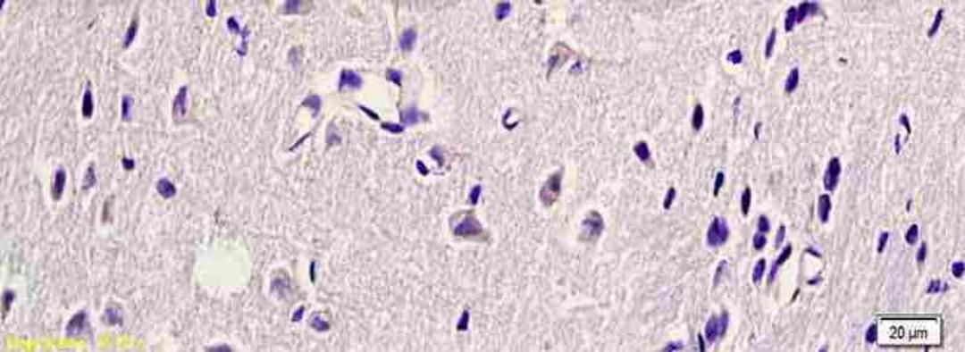 Immunohistochemical analysis of paraffin-embedded rat brain tissue using HSP27 antibody.