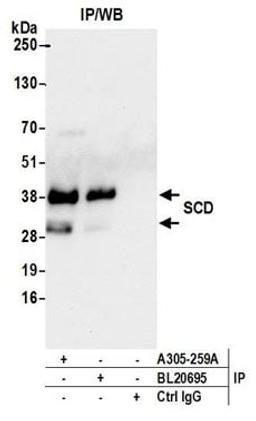 Detection of human SCD by western blot of immunoprecipitates.