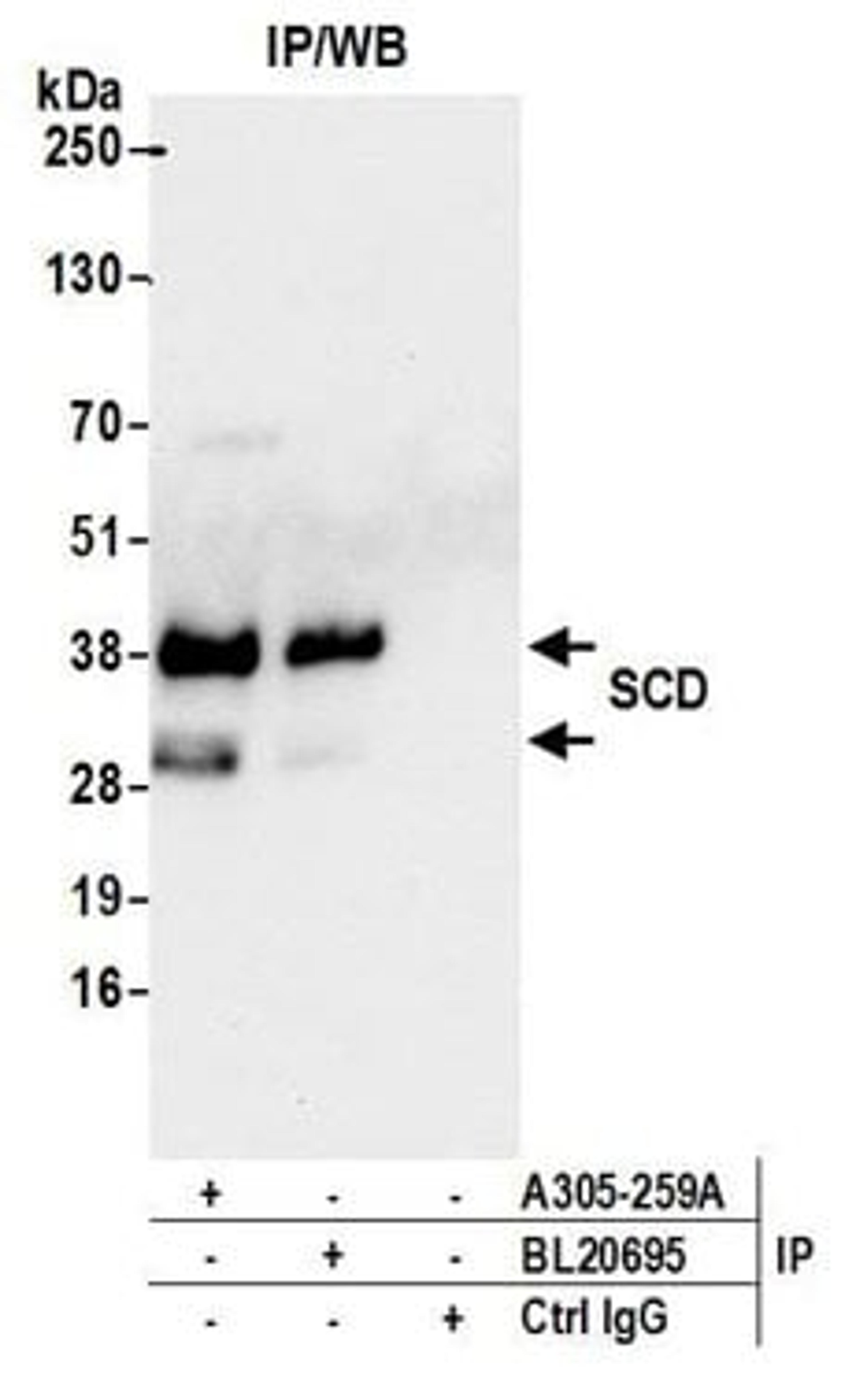 Detection of human SCD by western blot of immunoprecipitates.