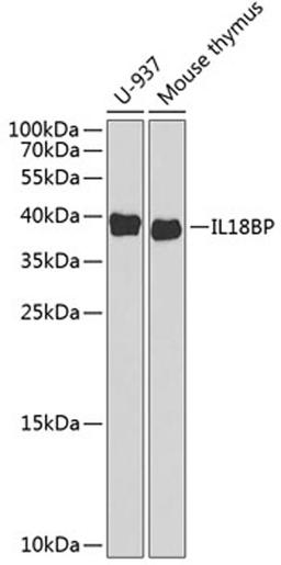 Western blot - IL18BP antibody (A6445)