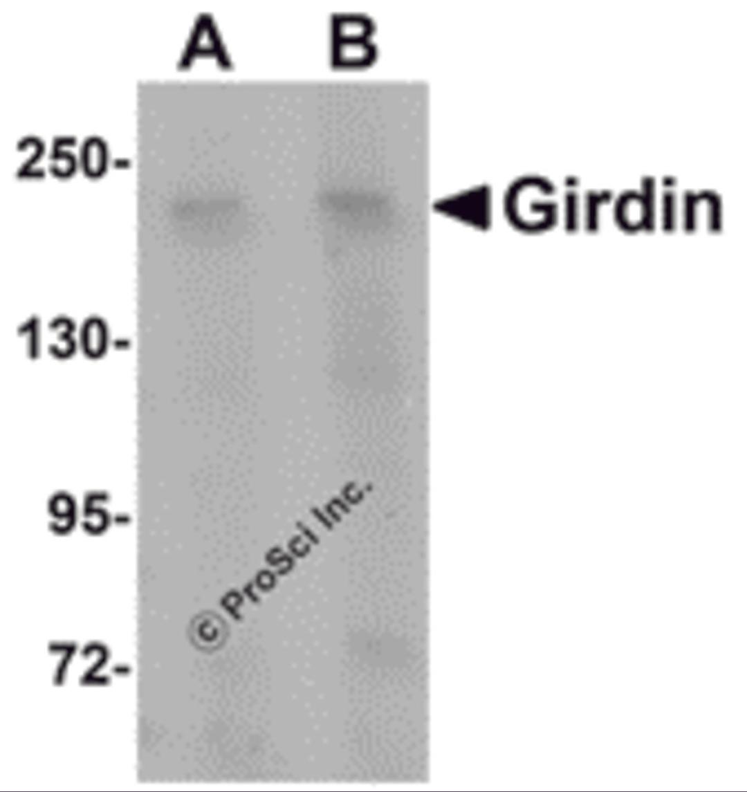 Western blot analysis of Girdin in rat brain tissue lysate with Girdin antibody at (A) 1 and (B) 2 μg/mL.