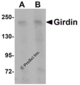 Western blot analysis of Girdin in rat brain tissue lysate with Girdin antibody at (A) 1 and (B) 2 μg/mL.