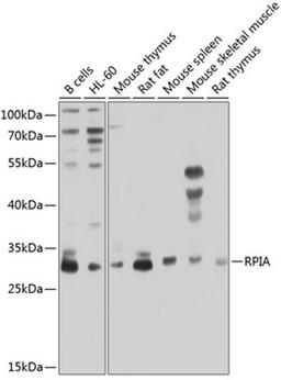 Western blot - RPIA antibody (A8867)