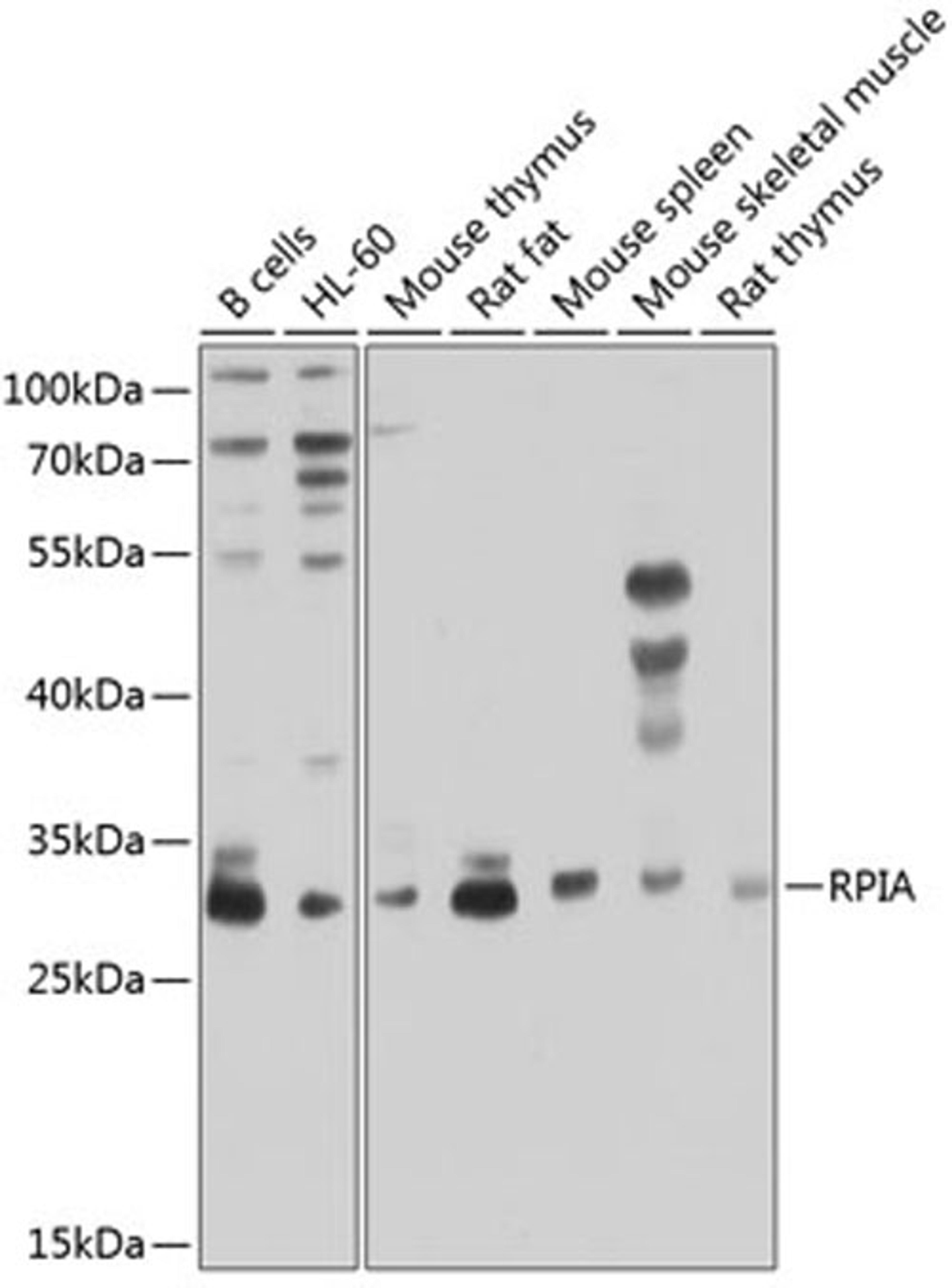 Western blot - RPIA antibody (A8867)