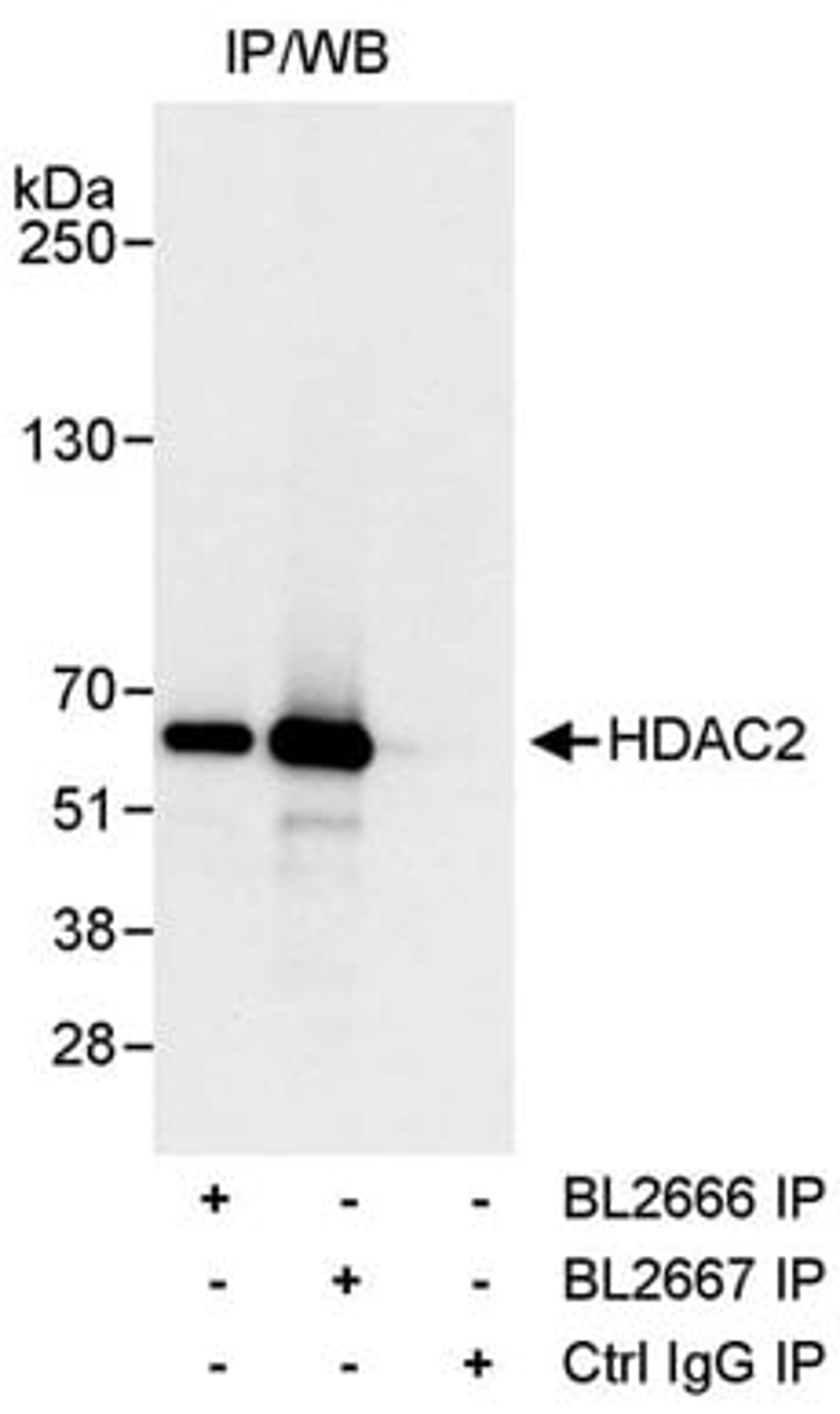 Detection of human HDAC2 by western blot of immunoprecipitates.