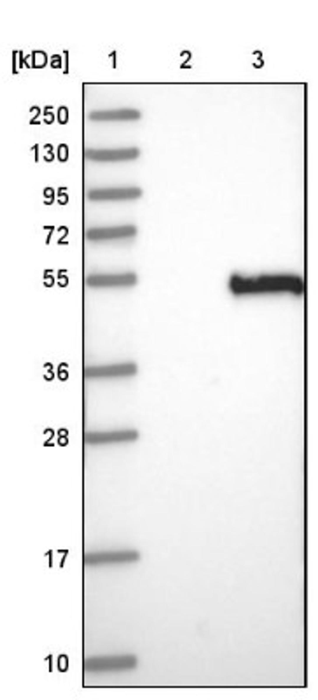 Western Blot: Decorin Antibody [NBP1-84970] - Lane 1: Marker [kDa] 250, 130, 95, 72, 55, 36, 28, 17, 10<br/>Lane 2: Negative control (vector only transfected HEK293T lysate)<br/>Lane 3: Over-expression lysate (Co-expressed with a C-terminal myc-DDK tag (~3.1 kDa) in mammalian HEK293T cells, LY403339)