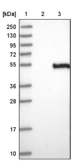 Western Blot: Decorin Antibody [NBP1-84970] - Lane 1: Marker [kDa] 250, 130, 95, 72, 55, 36, 28, 17, 10<br/>Lane 2: Negative control (vector only transfected HEK293T lysate)<br/>Lane 3: Over-expression lysate (Co-expressed with a C-terminal myc-DDK tag (~3.1 kDa) in mammalian HEK293T cells, LY403339)