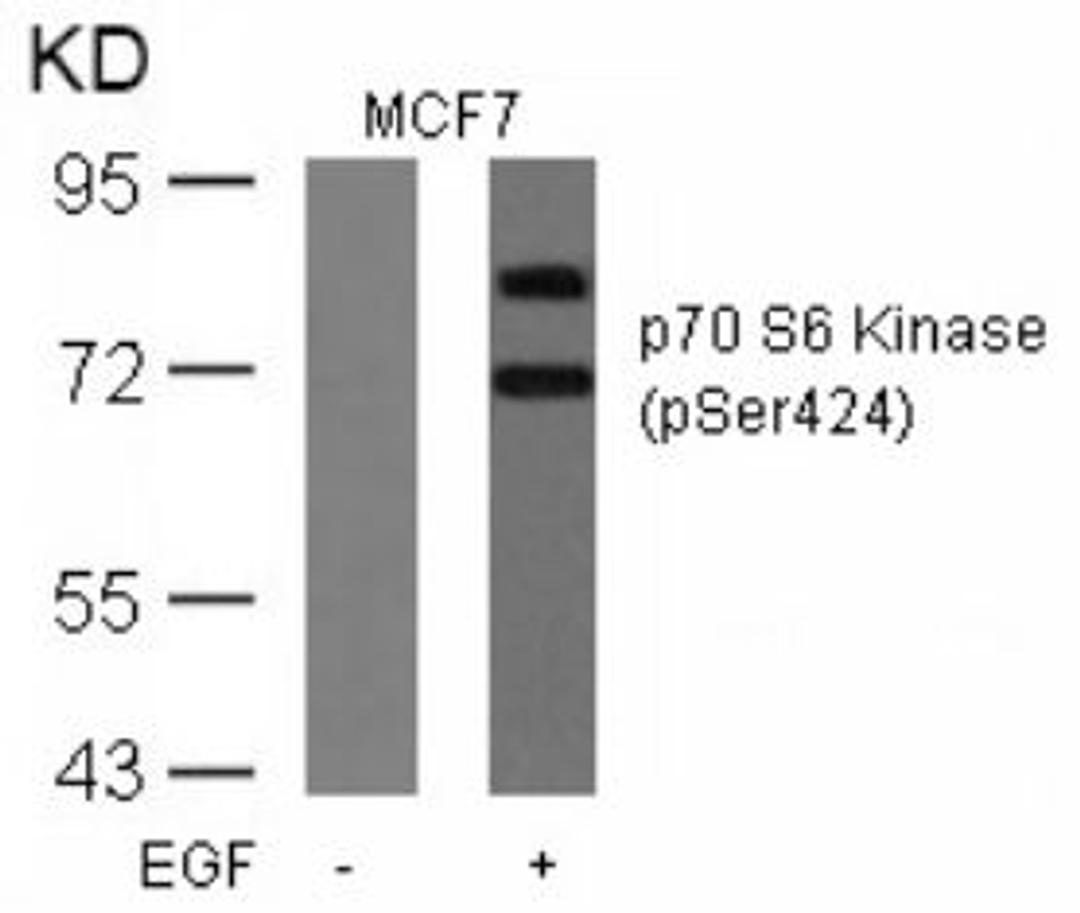 Western blot analysis of lysed extracts from MCF cells untreated or treated with EGF using p70 S6 Kinase (Phospho-Ser424).